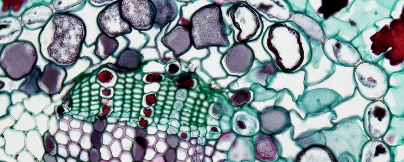 Microscopic image of amniotic membrane tissue showcasing cellular structures and biological materials relevant to wound regeneration and healing processes.