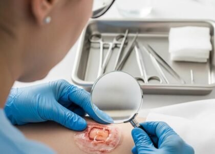 Healthcare professional examining wound exudate in a clinical setting