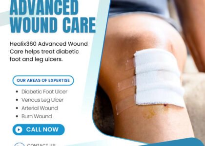 ### Key Elements

**Main Subjects**  
- A bandaged leg with a visible wound.

**Objects**  
- Bandage covering the wound.
- Text promoting Healix360 Advanced Wound Care services.

**Notable Features**  
- Clear branding of Healix360.
- Areas of expertise highlighted: Diabetic Foot Ulcer, Venous Leg Ulcer, Arterial Wound, Burn Wound.

**Text/Symbols**  
- Contact information: 877-545-1300.
- Call to action: "CONTACT US" and "CALL NOW."

### Overall Mood/Theme  
The image conveys a professional and caring approach to wound care, focusing on specialized treatment for serious conditions. The clean design and informative text suggest a sense of urgency and support for patients in need.
