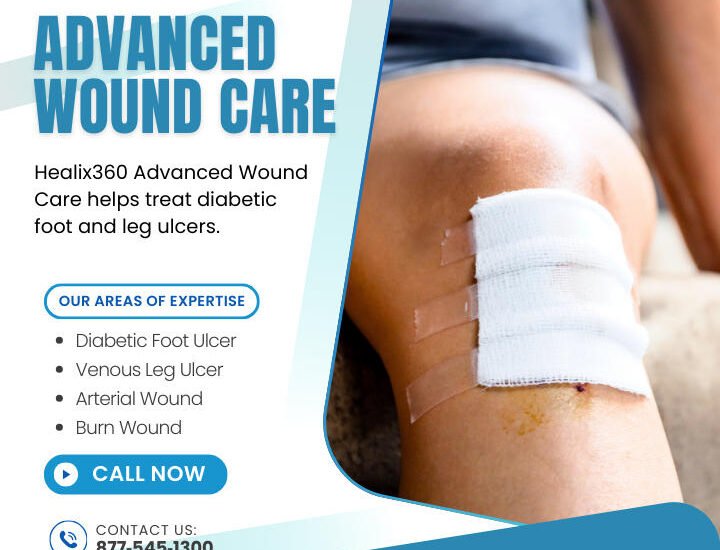 ### Key Elements

**Main Subjects**  
- A bandaged leg with a visible wound.

**Objects**  
- Bandage covering the wound.
- Text promoting Healix360 Advanced Wound Care services.

**Notable Features**  
- Clear branding of Healix360.
- Areas of expertise highlighted: Diabetic Foot Ulcer, Venous Leg Ulcer, Arterial Wound, Burn Wound.

**Text/Symbols**  
- Contact information: 877-545-1300.
- Call to action: "CONTACT US" and "CALL NOW."

### Overall Mood/Theme  
The image conveys a professional and caring approach to wound care, focusing on specialized treatment for serious conditions. The clean design and informative text suggest a sense of urgency and support for patients in need.