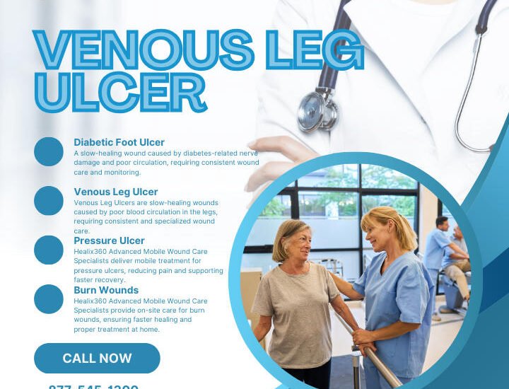 ### Key Elements

**Main Subjects:**
- Healthcare professionals assisting patients.

**Objects:**
- Medical equipment and tools related to wound care.

**Notable Features:**
- Contact information prominently displayed.
- Clear headings for different types of ulcers and treatments.

**Text/Symbols:**
- "Healix360 Comprehensive Care" as the main branding.
- Various types of ulcers listed: Diabetic Foot Ulcer, Venous Leg Ulcer, Pressure Ulcer, Burn Wounds.

### Overall Mood/Theme
The image conveys a professional and supportive healthcare environment focused on specialized wound care. The use of blue and white colors suggests cleanliness and trust, while the presence of healthcare workers interacting with patients promotes a sense of care and compassion.